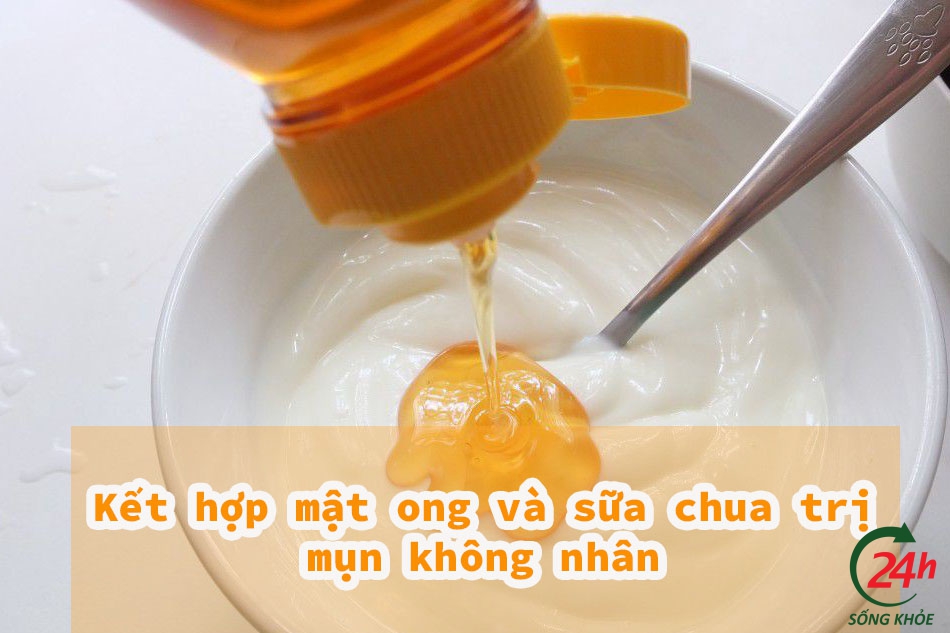 Kết hợp mật ong và sữa chua trị mụn không nhân