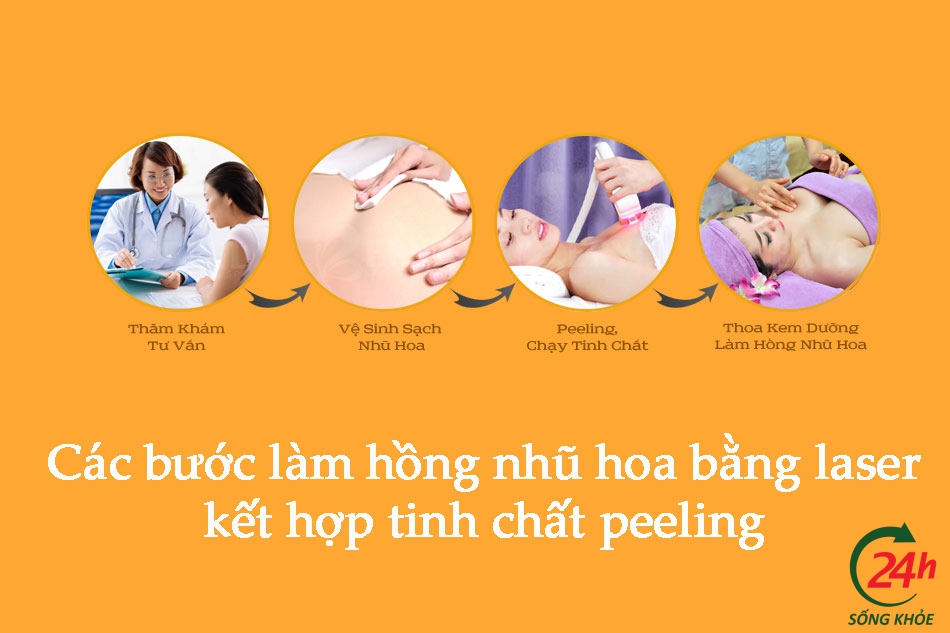 Các bước làm hồng nhũ hoa bằng laser kết hợp tinh chất peeling