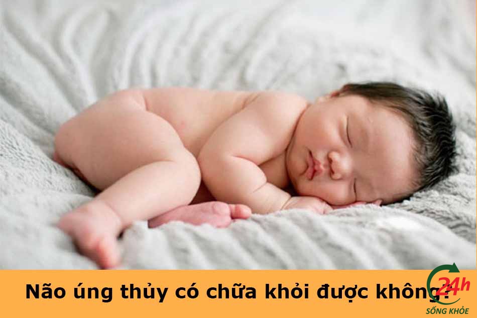 Não úng thủy có chữa khỏi được không?
