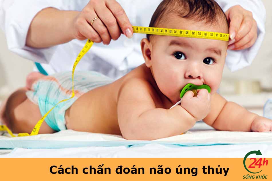 Cách chẩn đoán não úng thủy