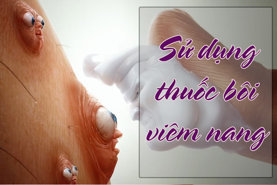 Dùng thuốc bôi viêm nang lông vùng kín