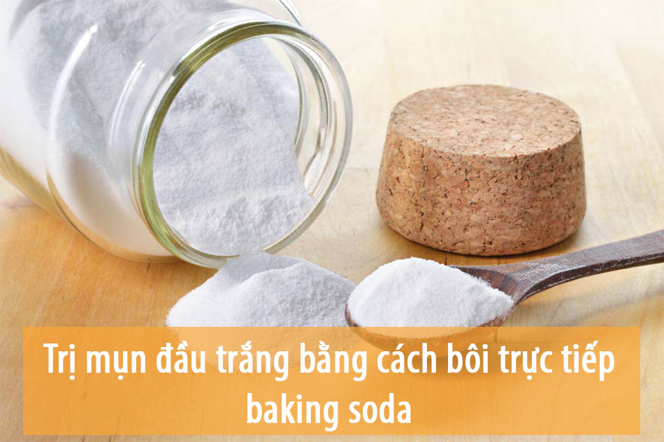 Trị mụn đầu trắng (mụn cám) bằng cách bôi trực tiếp baking soda