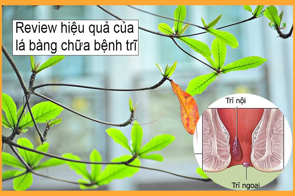 Review hiệu quả của lá bàng chữa bệnh trĩ