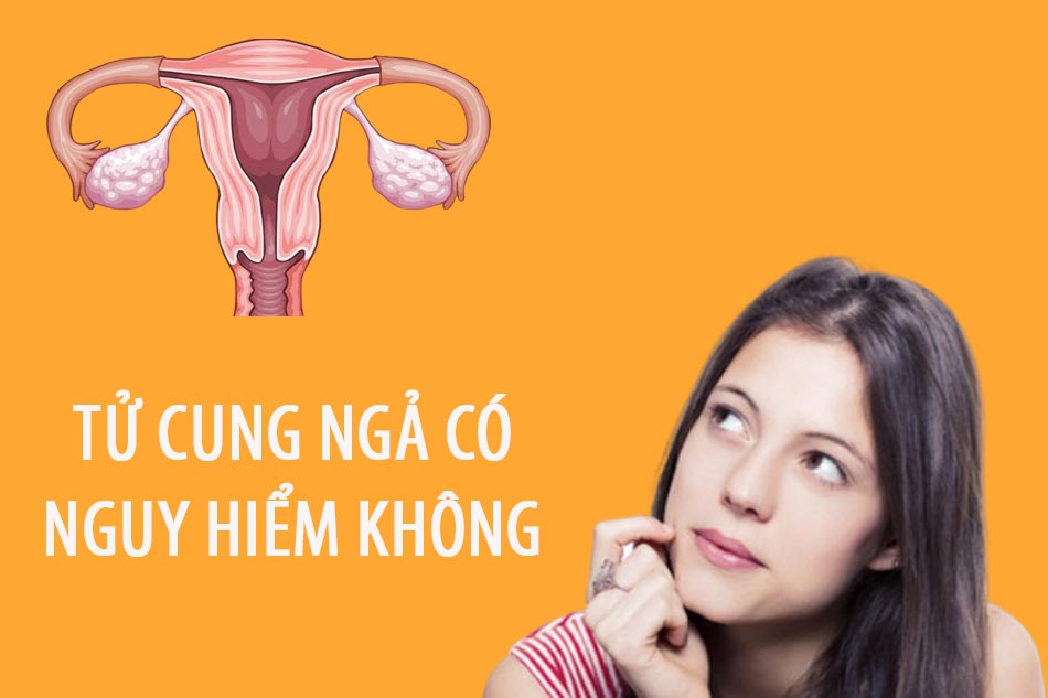 Tử cung ngả có nguy hiểm không?