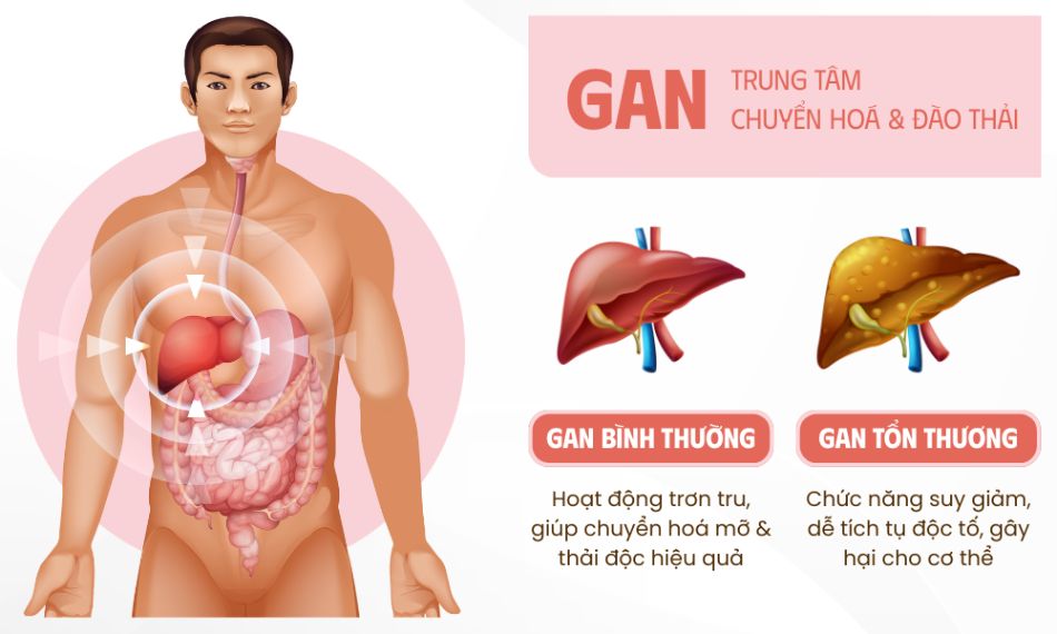 Trà MaxUp - Giải pháp hỗ trợ mát gan giải độc, thanh lọc cơ thể từ thảo dược